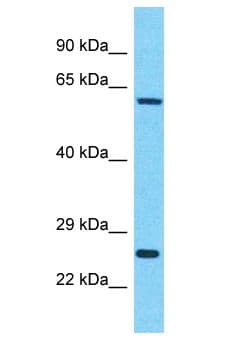 IDH3B Antibody (aa44-93)
