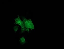 BCAR1 / p130Cas Antibody (clone OTI1B1)