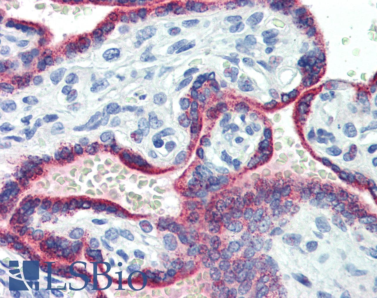 Polyclonal Rabbit anti-Human ASH2L / ASH2 Antibody (aa288-337, IHC, WB)
