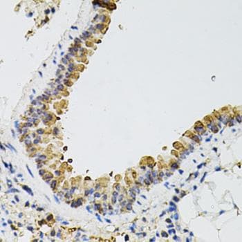 ARHGEF2 / GEF-H1 Antibody