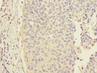 CALML3 Antibody