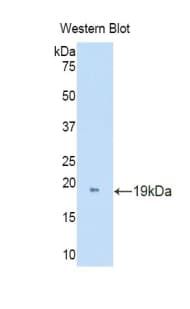 DDO / D-Aspartate Oxidase Antibody (aa170-304, Cy3)