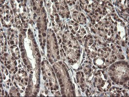 MME / CD10 Antibody (clone OTI3D11)
