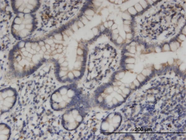 Monoclonal Mouse anti-Human KIF1C Antibody (clone 1F12, IHC, WB)