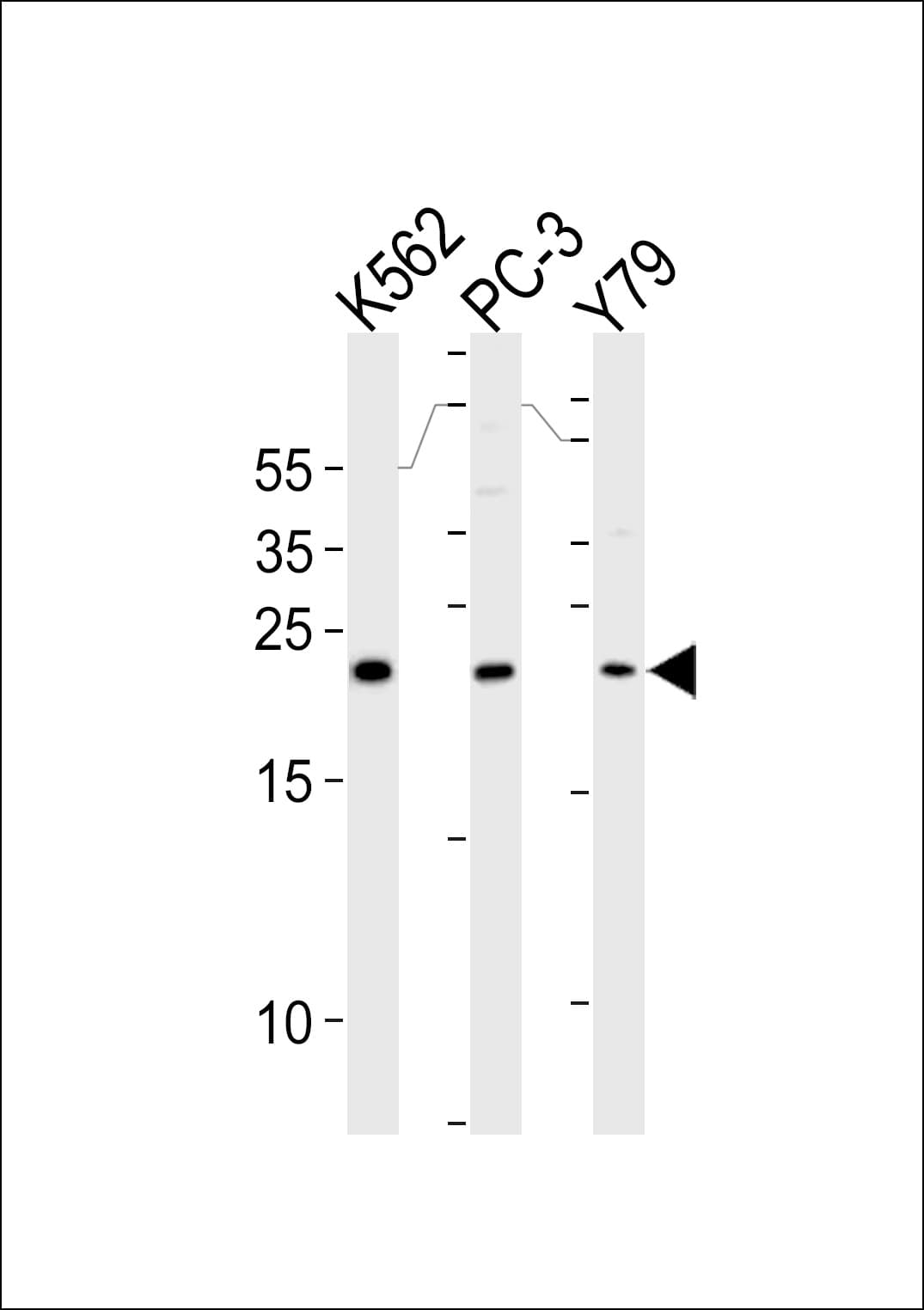 GSTP1 / GST Pi Antibody (aa165-192)