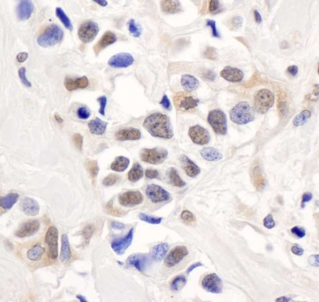 Polyclonal Rabbit anti-Human PALB2 Antibody (aa200-250, WB)
