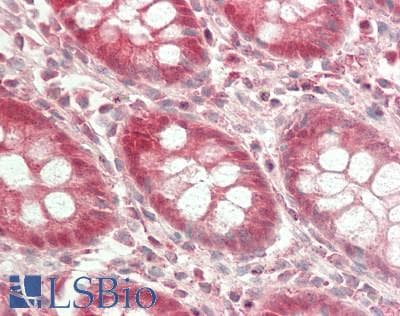 IHC-plus™ PYCARD / ASC / TMS1 Antibody