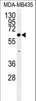 IHC-plus™ ERO1LB Antibody (aa266-293)