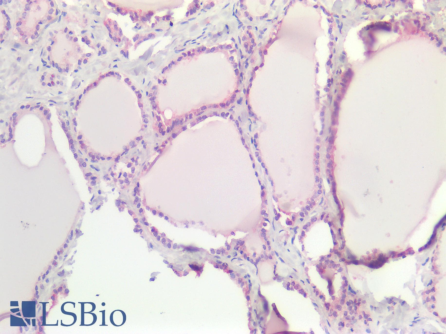 IHC-plus™ DLX2 Antibody