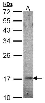 HR6B / UBE2B Antibody