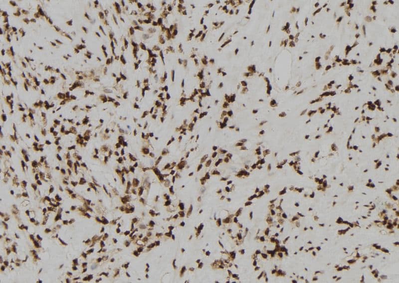Polyclonal Rabbit anti-Human Acrosin Antibody (IHC, IF, WB)