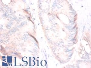 MSTN / GDF8 / Myostatin Antibody (FITC)