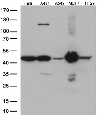 KRT18 / CK18 / Cytokeratin 18 Antibody (aa69-372, clone OTI3D1)