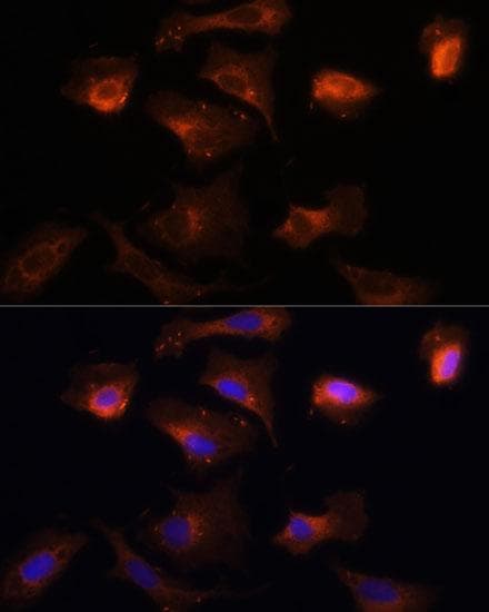 PINK1 Antibody