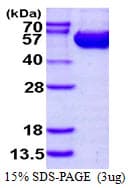 Human ASL / Argininosuccinate Lyase Protein (Recombinant His)