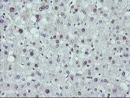 MAP2K1 / MKK1 / MEK1 Antibody (clone OTI2F1)