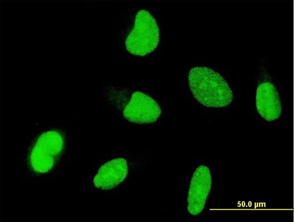Monoclonal Mouse anti-Human OTX1 Antibody (clone 1F2, IF, WB)