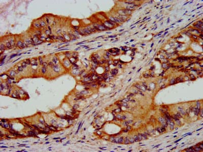 RGS6 Antibody