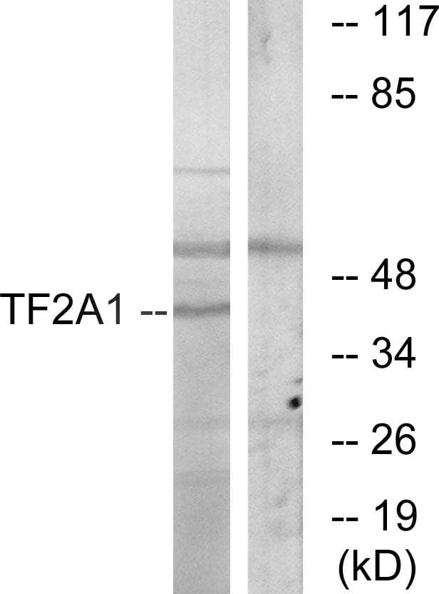 Polyclonal Rabbit anti-Human GTF2A1 / TFIIA Antibody (WB)