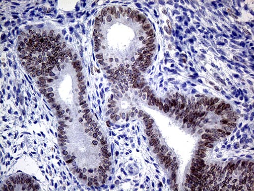 Monoclonal Mouse anti-Human MLH1 Antibody (clone OTI3D1, aa299-527, IHC, WB)
