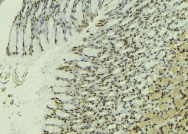 Polyclonal Rabbit anti-Human PAWR / PAR4 Antibody (IHC, IF, WB)