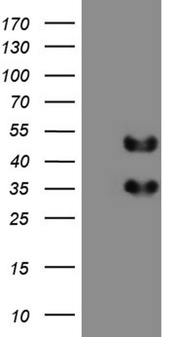 FOSB Antibody (aa1-255, clone OTI6H6)