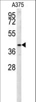 SLC35B2 Antibody (aa393-421)