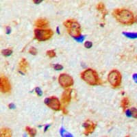 NF-L / NEFL Antibody (Internal)