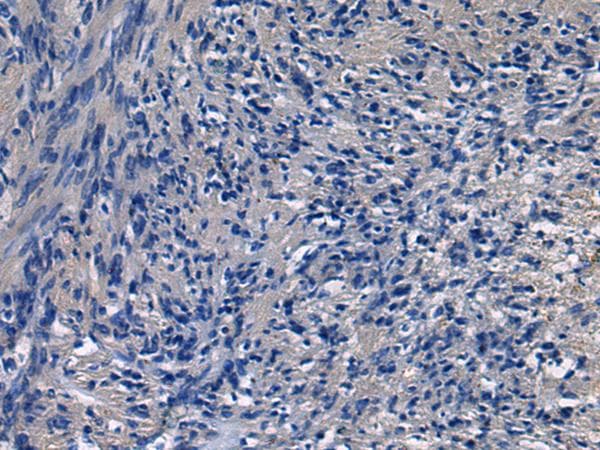 ICA69 / ICA1 Antibody