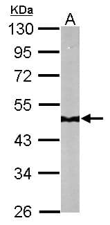 IHC-plus™ NDUFS2 Antibody (aa200-430)