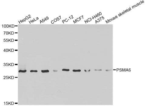 Polyclonal Rabbit anti-Human PSMA6 Antibody (IHC, IF, WB)