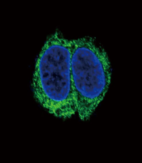 PathPlus™ TGFBR2 Antibody (aa13-40)
