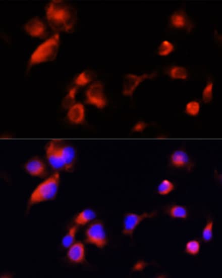 Polyclonal Rabbit anti-Human APOE / Apolipoprotein E Antibody (AP, IHC, IF)