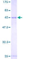 Human TGDS Protein (Recombinant GST)