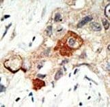 Polyclonal Rabbit anti-Human UBE2I / UBC9 Antibody (aa1-30, IHC, WB)
