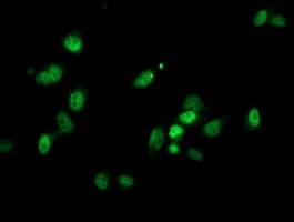 PGAM2 Antibody (clone OTI2H10, Carrier-free)
