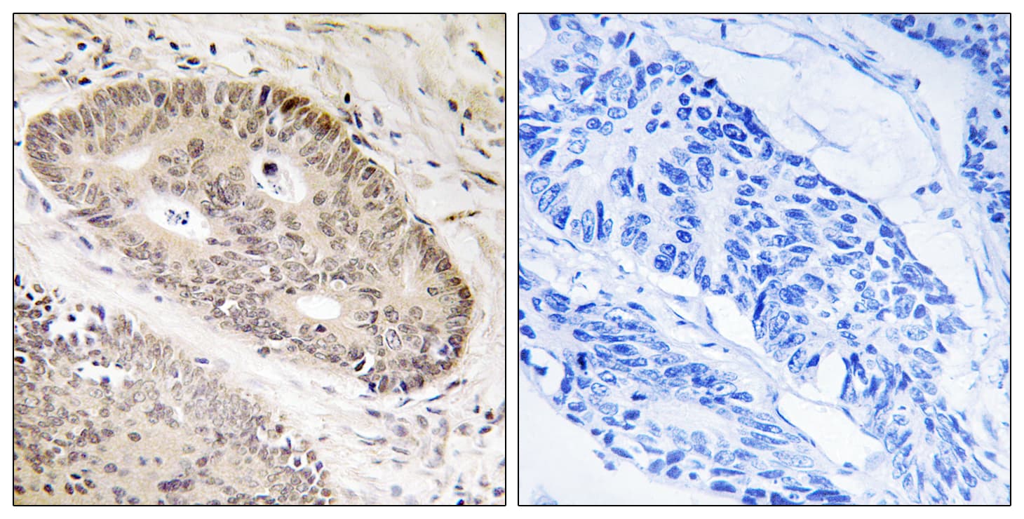 CARF / ALS2CR8 Antibody (aa311-360)