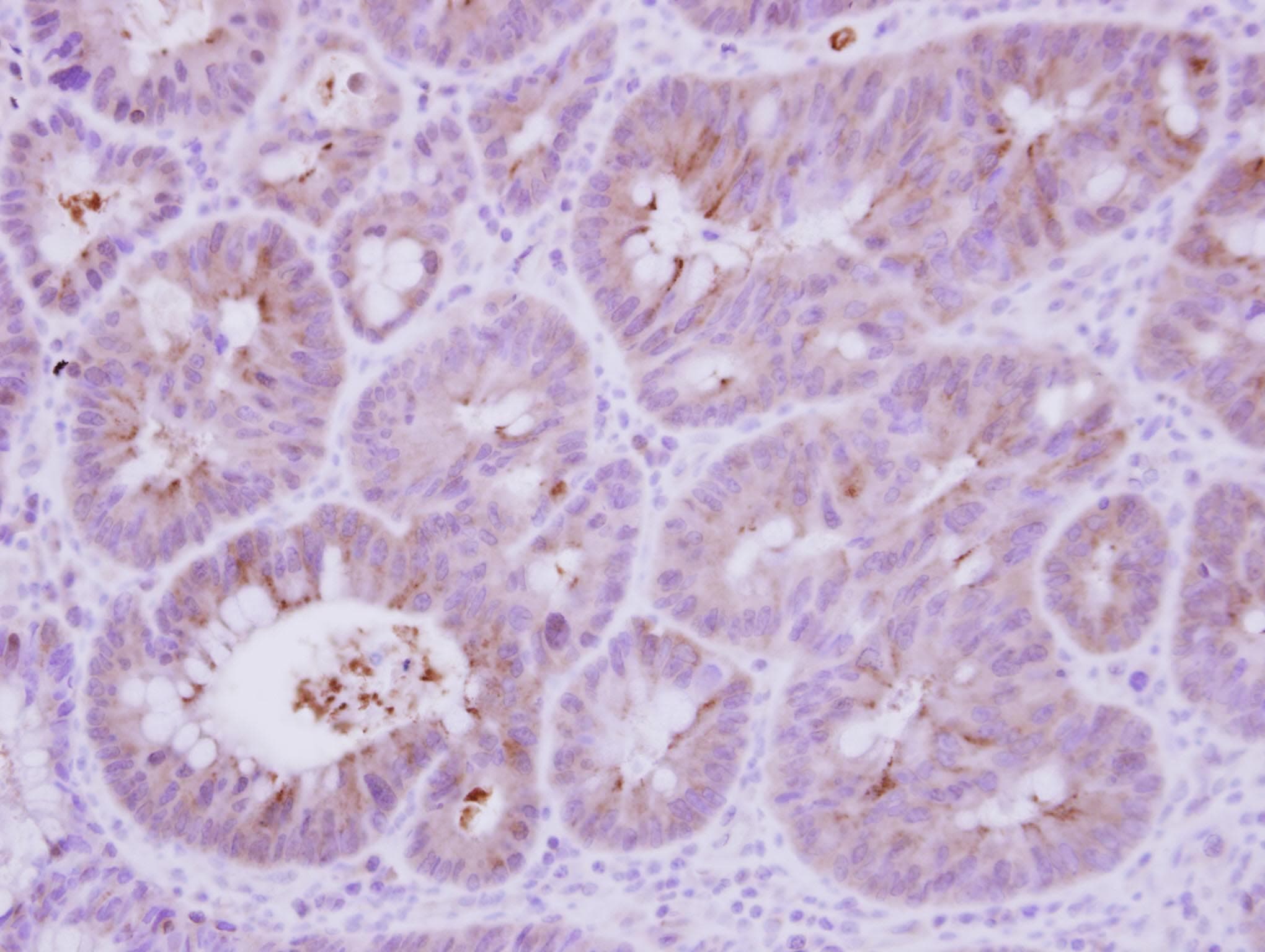 PPP3R1 / Calcineurin B Antibody