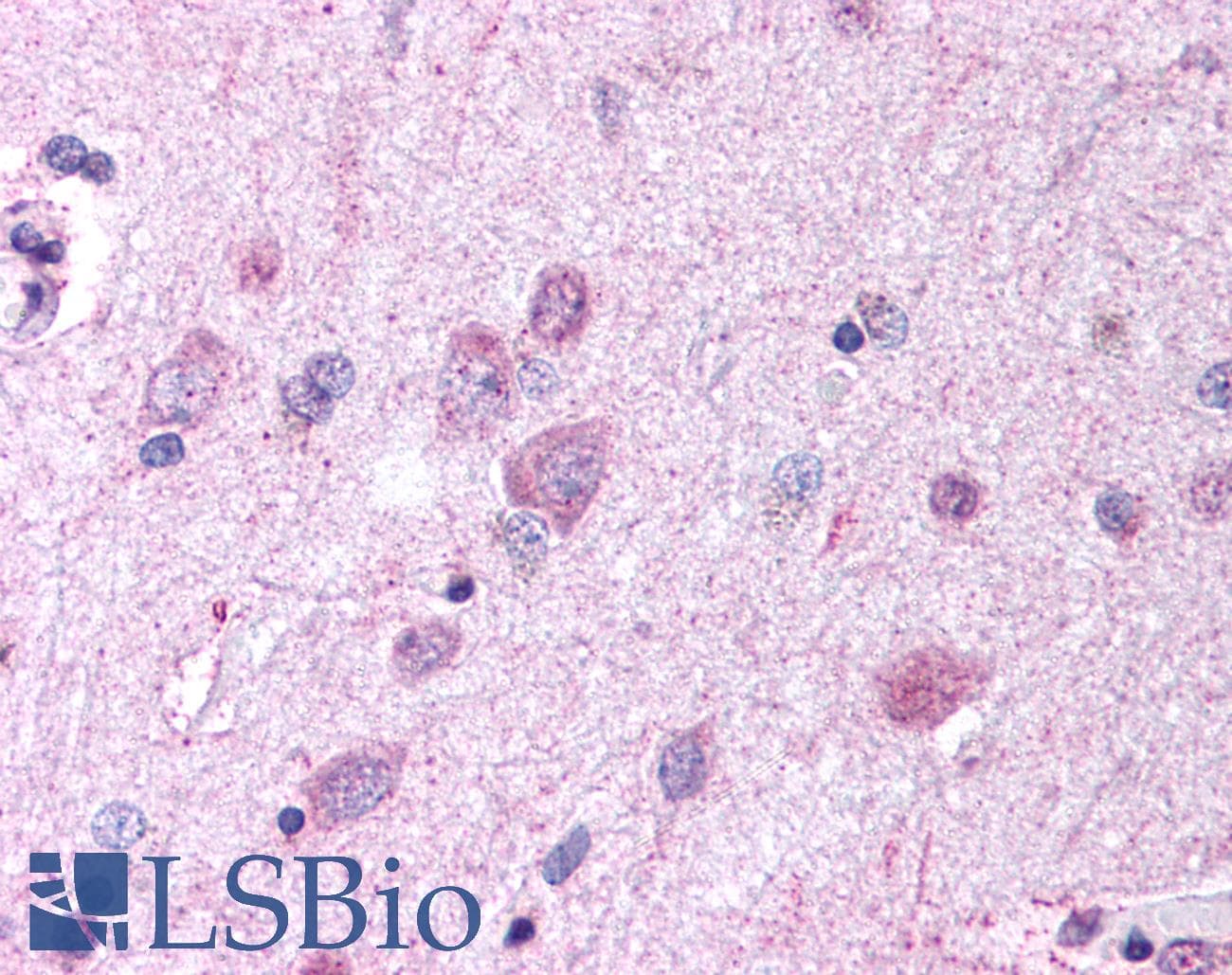 IHC-plus™ PAEL Receptor / GPR37 Antibody (N-Terminus)
