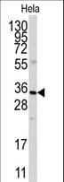ANXA3 / Annexin A3 Antibody (aa1-30)