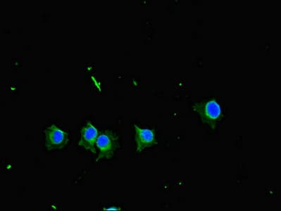 NAK / TBK1 Antibody