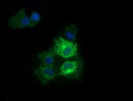 RARRES1 Antibody (clone OTI1B8)