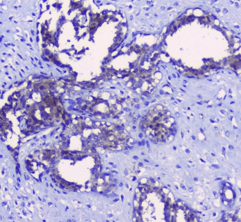Polyclonal Rabbit anti-Human SRI / Sorcin Antibody (IHC, WB)
