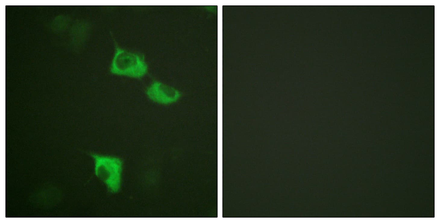 IHC-plus™ EEF2 / Elongation Factor 2 Antibody (aa31-80)