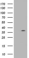 RASSF1 / RASSF1A Antibody (clone OTI2A9)