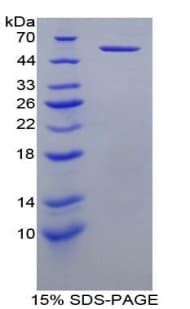 Human KIR3DL1 Protein (Recombinant His-GST)