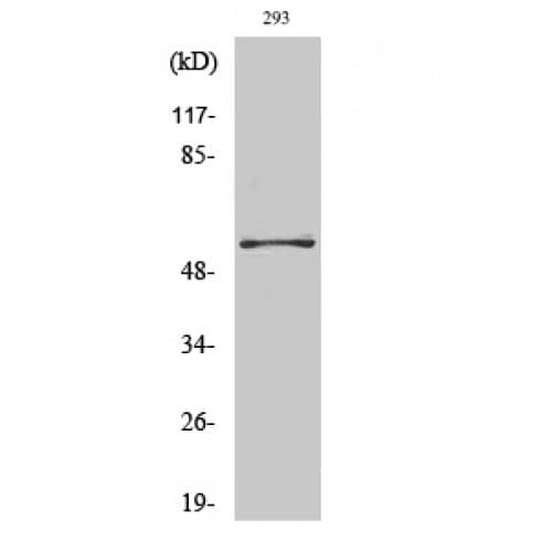 PFKFB2 Antibody (420-500 aa)
