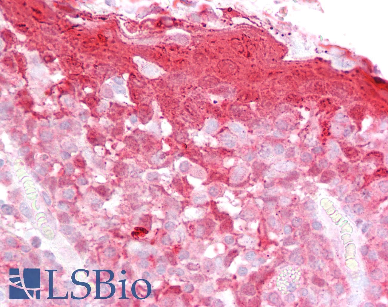 IHC-plus™ Polyclonal Goat anti-Human CSTB / Cystatin B / Stefin B Antibody (aa86-98, IHC, WB)