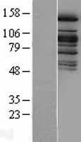 KDM6A / UTX Protein (Over-Expression Lysate Myc-DDK (Flag))
