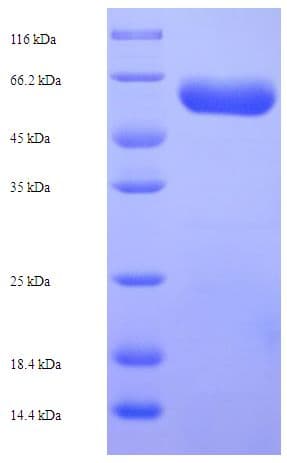Bovine L2HGDH Protein (Recombinant His-SUMO)